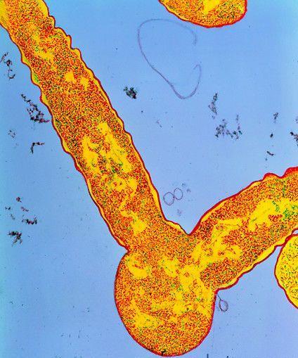 Figura 3. Efeito da penicilina na bactéria Escherichia coli. Na parte inferior vemos o corpo central arredondado da bactéria, onde temos protrusões na parte esquerda e direita superior.