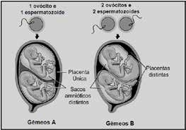 Nesses casos, o feto recebe menos oxigênio e nutrientes porque a) a circulação placentária é interrompida. b) apenas sangue venoso circula na placenta. c) menos sangue materno circula na placenta.