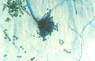 Uni ou Multicelulares Material genético envolto em membrana Eucarioto Fungos