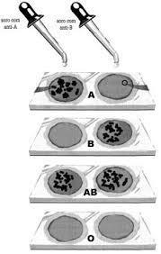 Aglutinação A aglutinação é um processo simples de identificação do fenótipo no grupo sanguíneo ABO.