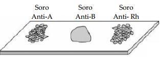 4. Além do teste de DNA, há exames mais simples que podem ajudar a esclarecer dúvidas sobre paternidade.