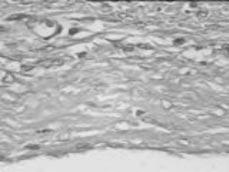 Figura 1 - Peritônio da área doadora evidenciando regeneração mesotelial e transformação do tecido conjuntivo frouxo em tecido conjuntivo