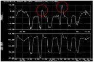 9-1 -1 20 25 % Gradual Wall Loss 7 A 9-2 -1 20 25 % Gradual Wall Loss 8 A 9-3 -1 25 30 % Gradual Wall Loss 9 A 9-4 -1 20 25 % Gradual Wall Loss 10 A