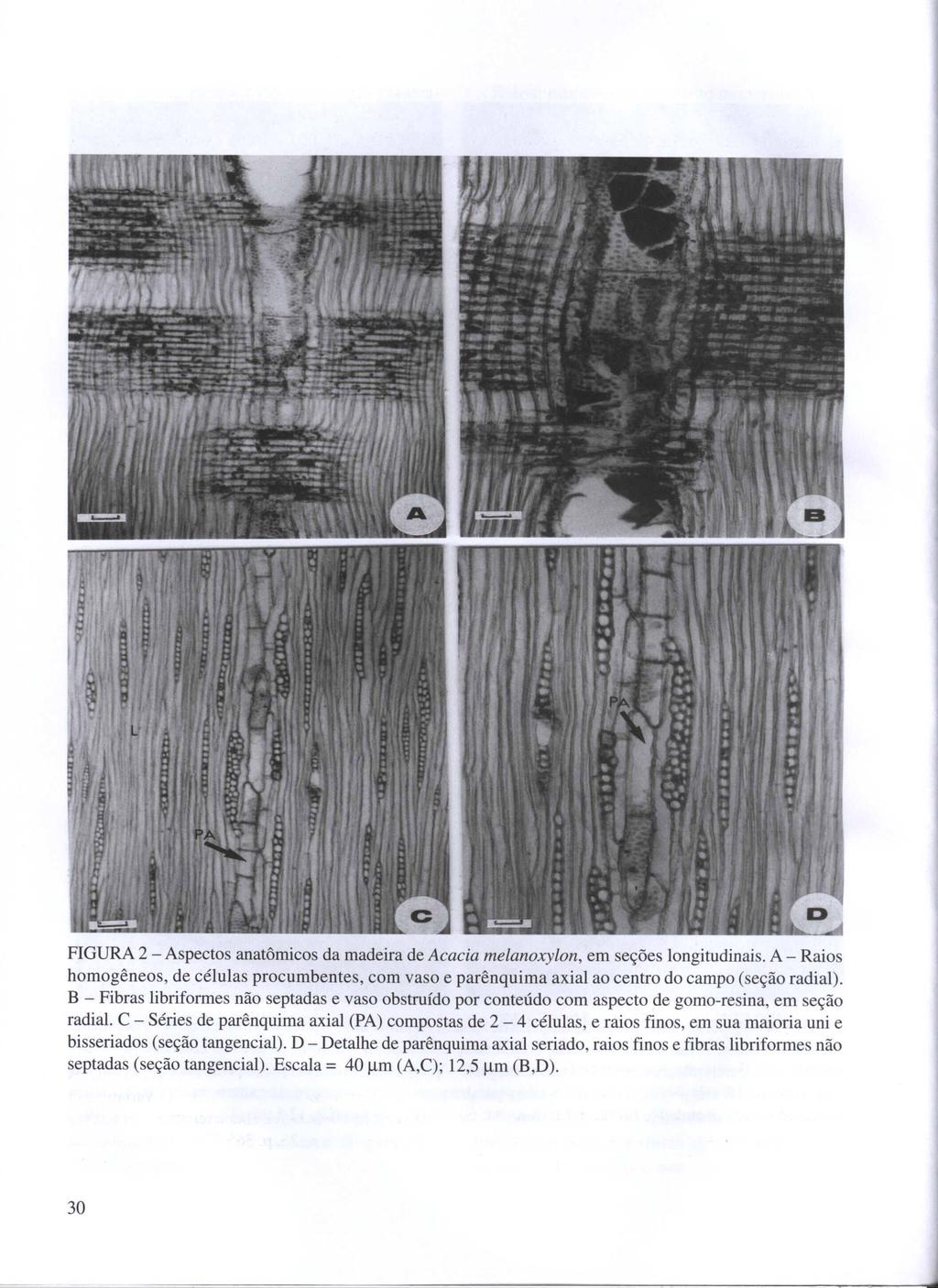 FIGURA 2 - Aspectos anatômicos da madeira de Acaeia melanoxylon, em seções longitudinais. A - Raios homogêneos, de células procumbentes, com vaso e parênquima axial ao centro do campo (seção radial).