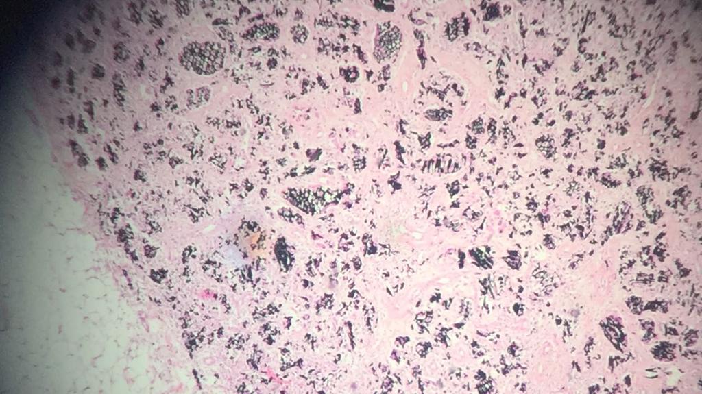 37 foram seccionados ao longo de seu eixo longitudinal em cortes de no máximo 2 mm, submetidos a processamento histológico, microtomia (4um) sendo posteriormente corados pelo método de Hematoxilina e