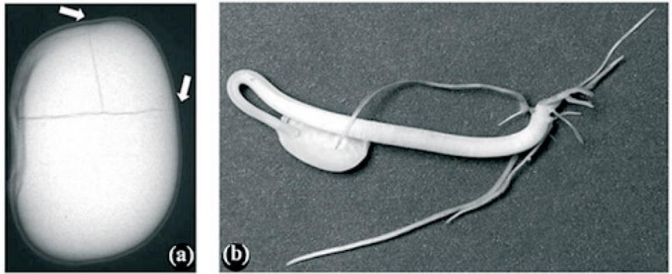 14 Figura 5 - Semente submetida a cinco impactos a 965,3KPa, resultando em danos mecânicos severos nos cotilédones e no eixo embrionário; imagem de raios X (a) e fotografia da plântula anormal