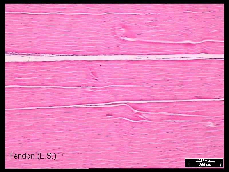 longitudinal Corte