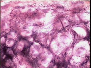 fibras colágenas Cartilagem reticular