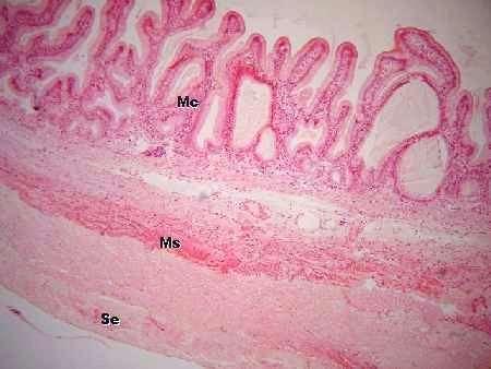 Mucosa: com dobras a) Tecido epitelial de revestimento cilíndrico simples b) Lâmina própria - tecido conjuntivo.