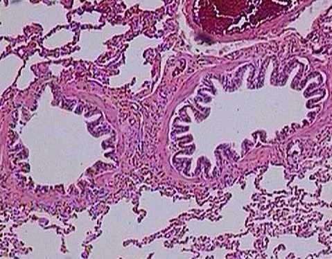 Bronquíolos A) Mucosa Tecido epitelial varia de cilíndrico simples ciliado,