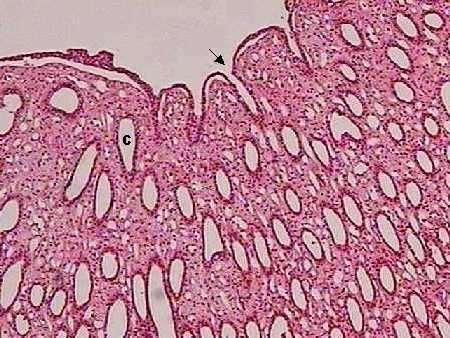 159 Região da papila renal: tubos coletores