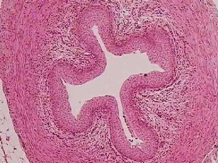 Ureter 1. Mucosa a) Tecido epitelial polimorfo.
