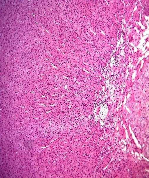 Cápsula (tecido conjuntivo) Adrenal Camada cortical: Ca Zona glomerulosa - cordões