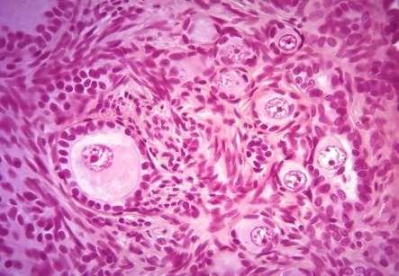 Folículo primordial (1) - ovócito I pequeno, rodeado por uma camada de células epiteliais achatadas.