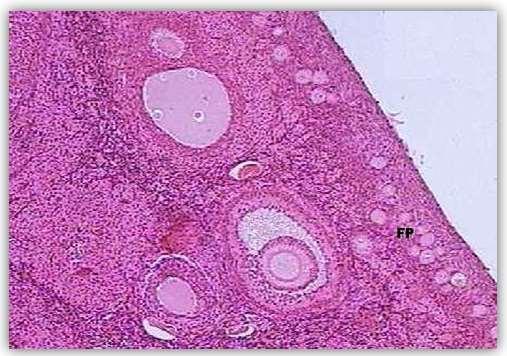 Ovário Região cortical T CO A Folículo antral (FA) Com a formação do