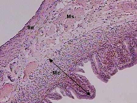 Tuba Uterina (Trompa Uterina, Tuba Uterina ou Oviduto) 1. Mucosa - Possui dobras ou pregas longitudinais, que são numerosas, longas e ramificadas na ampola.