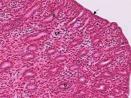 1. Mucosa (Endométrio) Útero a) Epitélio cilíndrico simples.