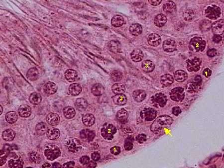 Túbulos seminíferos: Testículo - Célula de Sertoli (Sustentaculares - seta) - Espermatogônias (1) - Espermatócitos