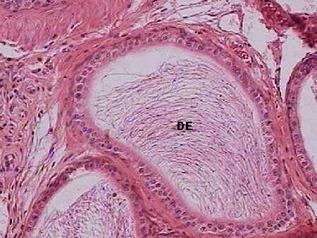 Epidídimo Cf Ml Ml Ep Ep DE HE 400x Cf