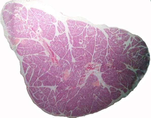 Glândula salivar mista (Glândula exócrina túbulo-acinosa composta) Cápsula - constituída de tecido conjuntivo que envia septos para o interior do órgão, delimitando lóbulos.