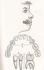 Quantos são? A dentição decídua é composta por 20 dentes: 8 incisivos, 4 caninos e 8 molares.