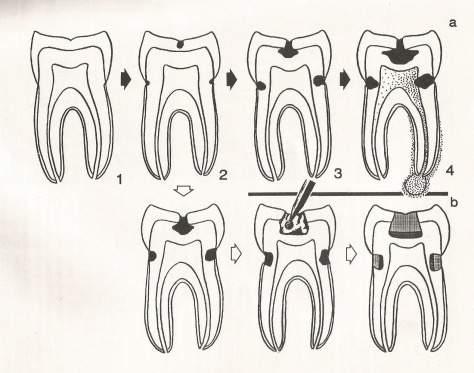 5 6 7 Fonte: Kirchner et al., 1992.