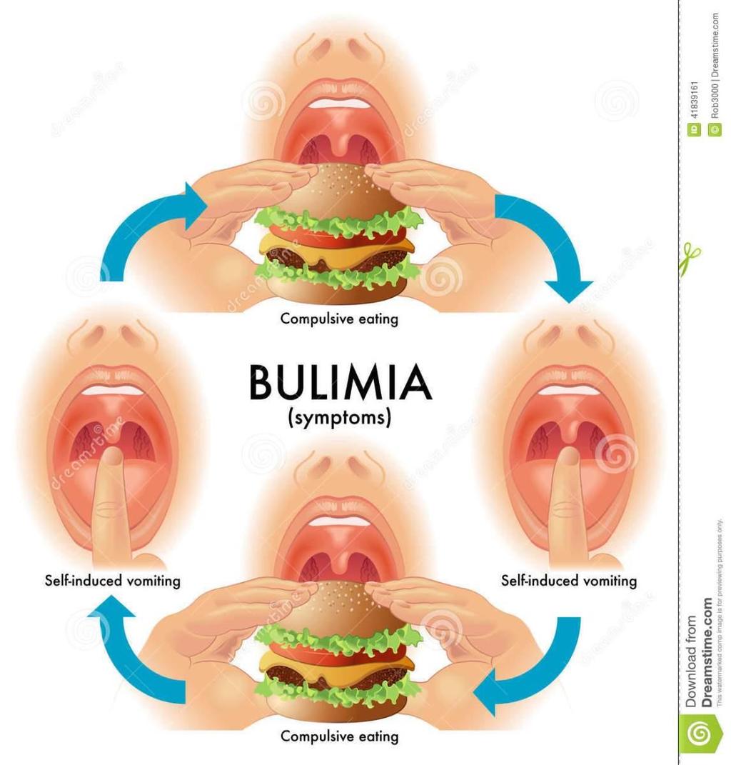 Bulimia Indícios: Indícios de compulsão alimentar; Idas frequentes ao banheiro logo após comer; Sigilo em relação
