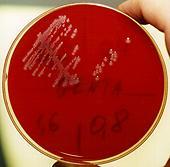 Bactericida Mínima (CBM)