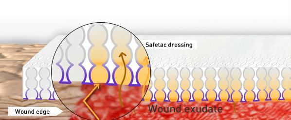 Remove e controla o excesso de exsudato Safetac sela toda a borda da ferida Força o exsudado a passar para o