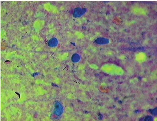 Secretaria de Vigilância em Saúde Figura 13. Inclusões de Lentz no neurônio infectado pelo vírus da cinomose Fonte: Instituto Pasteur 4.