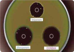 Menor potencial para selecção de P. aeruginosa resistentes Mushtaq et al. (2004): Doripenemo apresentou menor selecção de mutantes resistentes, comparativamente ao imipenemo ou meropenemo.