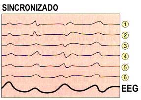 Transmissão continuo TÁLAMO N.