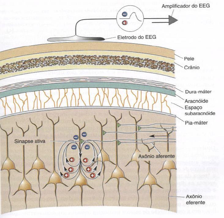 Registro eletroencefálico O EEG mede a diferença de correntes que fluem durante a excitação sináptica dos dendritos de muitos neurônios piramidais no córtex cerebral.