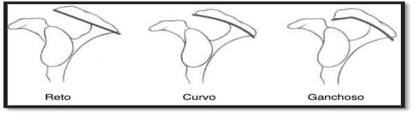 presença de acrômios curvos e ganchosos, a predisposição seria maior. A figura 7 representa os tipos de acrômio descritos por Bigliani.