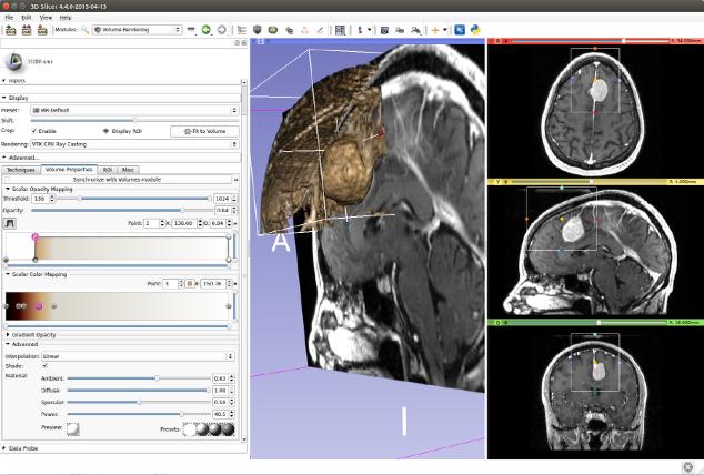 2 - Visualização 3D de tomografias computadorizadas Foi criado um um grupo composto por estudantes de medicina, de engenharia e eu, estudante de Design, para a partir dos exames propostos elaborarmos