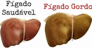 Obesidade Fígado