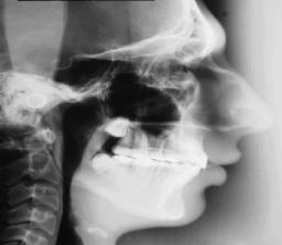 FIGURA 18: Radiografi a