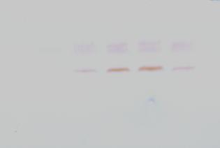 yellow mosaic virus in plants of C. baccatum var.