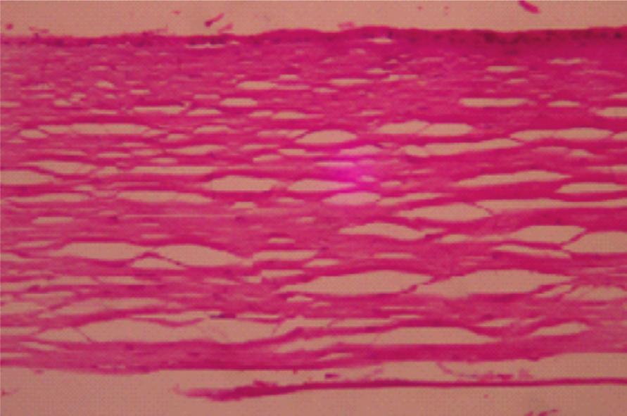 Foram registrados os casos de facectomia ou transplante de córnea prévios.