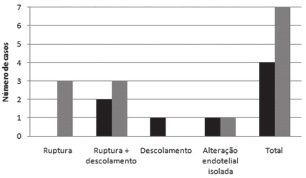 leve-moderado / grau II Gráfico 7 ceratopatia bolhosa após facectomia (preto) e falência após transplante (cinza) com edema acentuado / grau V DISCUSSÃO Gráfico 5 ceratopatia bolhosa após facectomia