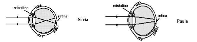 5. (UFMG 2004) Após examinar os olhos de Sílvia e de Paula, o oftalmologista apresenta suas conclusões a respeito da formação de imagens nos olhos de cada uma delas, na forma de diagramas