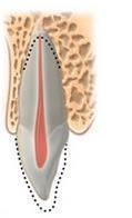 5 10. Os princípios do ajuste oclusal são, exceto: A) Evitar, sempre que possível, qualquer redução na altura das cúspides de contenção cêntrica.