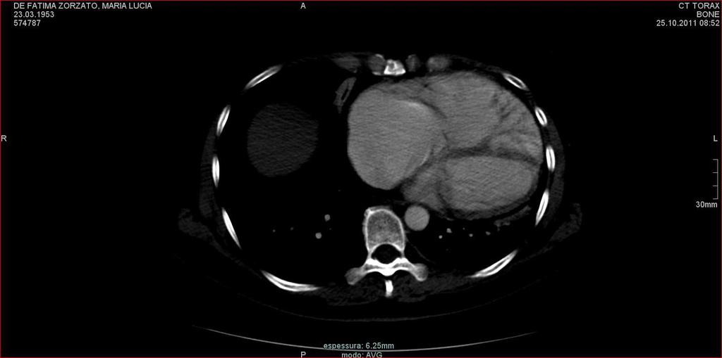 hemodiâmicos Maioria diagnosticada pelo