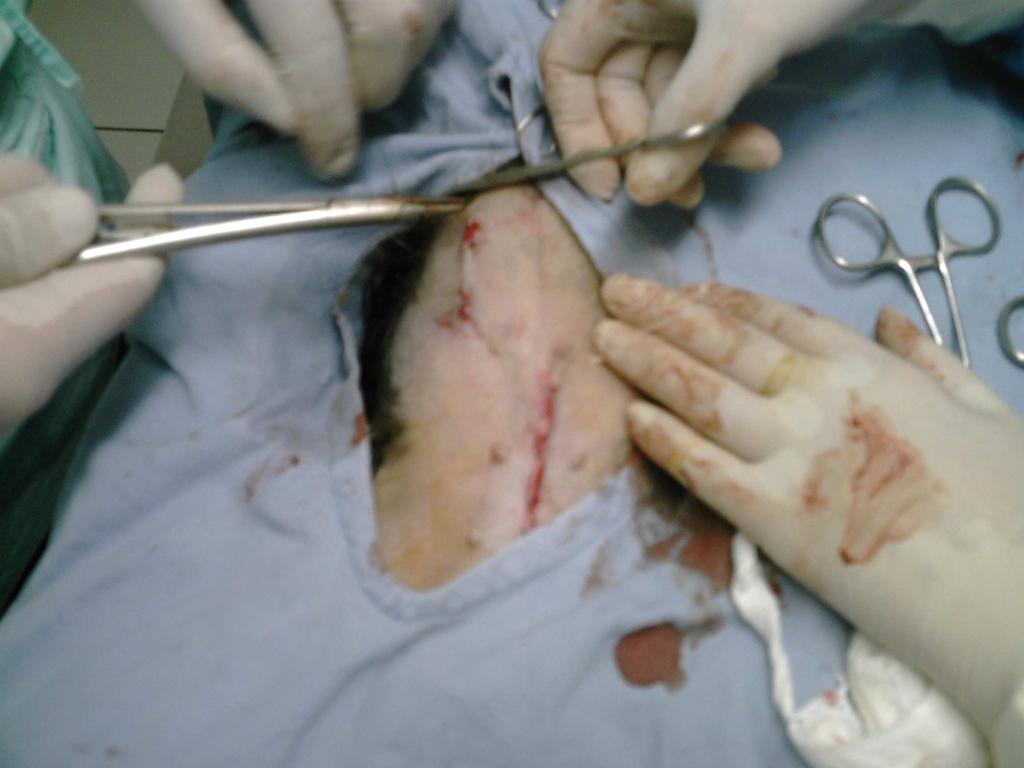 a cirurgia, as suturas deverão ser removidas, após 10 dias do