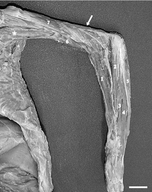 Figura 1. Membro torácico direito do bicho-preguiça (B. variegatus), vista caudal dos Mm. da articulação do ombro e cotovelo. M. supraespinhal (1); M. infraespinhal (2); M. redondo maior (3); M.