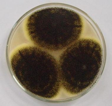 3. MATERIAL E MÉTODOS 3.1 Micro-organismo e preparo do inóculo A cepa do fungo de Aspergillus niger ATCC 9642 (Figura 4) foi cultivada em Potato Dextrose Ágar (PDA) durante 5 dias a 30 C.