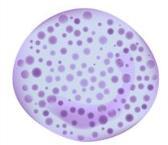 por mm 3 ) Glóbulos brancos