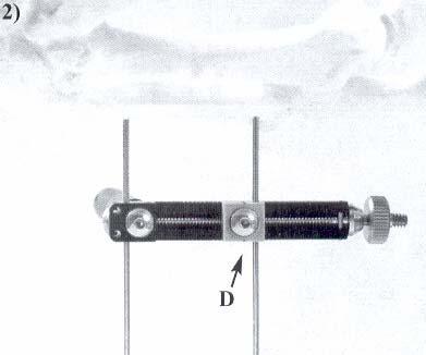 O grampo deve ser apertado o pino cortado à distância de 1 cm ou menos do distrator. O mesmo passo deve ser repetido para a inserção do segundo pino no grampo distal.