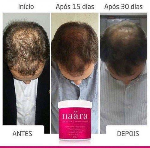 Este nutricosmético, realça sua beleza de dentro para fora, cabelos, unhas e pele ficam mais bonitos e resistentes.