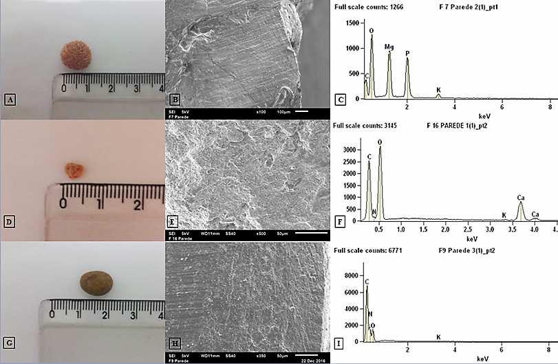 38 Fig 3. Urólitos de felinos. Urocistólito de estruvita (A). Imagem da camada de parede obtida por meio do MEV (B). Espectro de EDS da mesma região, determinando a composição de estruvita (C).